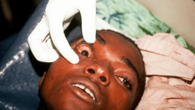 Photo of PANDEMIC ALERT: Deadly ‘No-Cure’ Marburg Virus Strikes Tanzania and Equatorial Guinea
