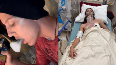 Photo of Teen Claims Vaping Gave Him Collapsed Lung and “30-Year-Old Smoker” Lungs