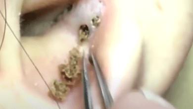 Photo of Doctors Discuss A Gross Video, And This Can Easily Happen To You!