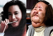 Photo of This Super Model Did Something That Ruined Her Face Forever