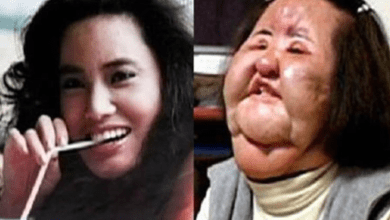 Photo of This Super Model Did Something That Ruined Her Face Forever